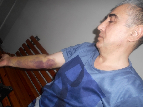 Джахонгир Умаров после избиения